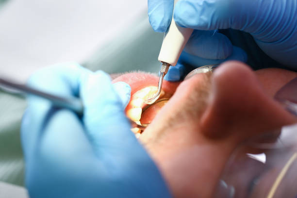 Best Emergency Treatment for Dental Infections or Abscesses in Elk Grove Vlage, IL